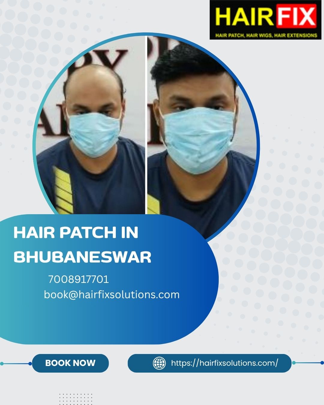 Hair patch in Bhubaneswar